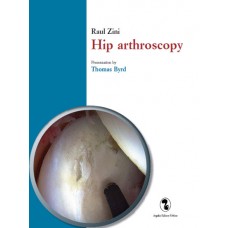 Zini R. Hip arthroscopy